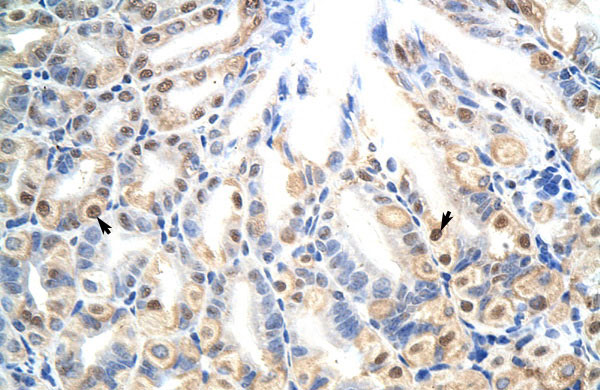 2 - E2f7 antibody - N-terminal region AI11260