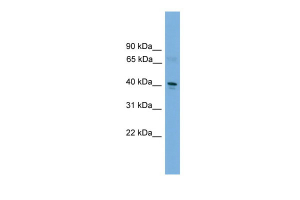 1 - Tfdp2 antibody - C-terminal region AI11262