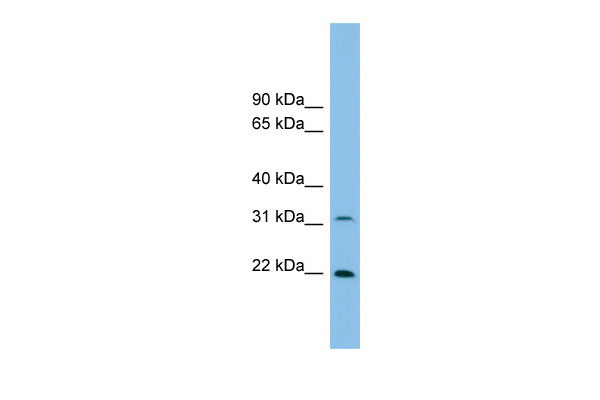 1 - Foxn2 antibody - N-terminal region AI11267