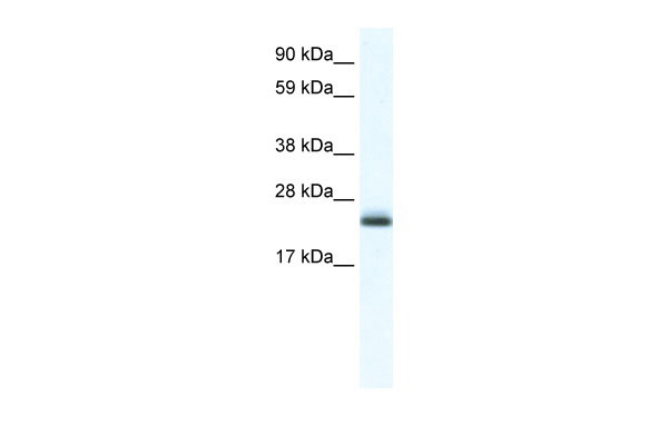 1 - Tppp antibody - C-terminal region AI11269