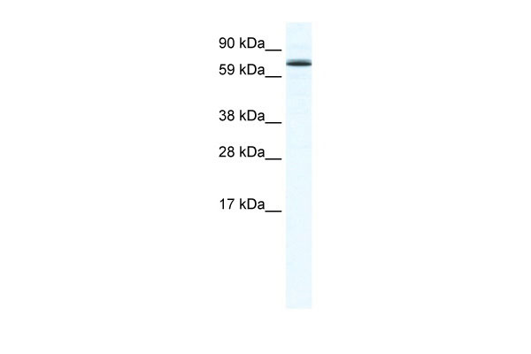 1 - FOXO6 antibody - N-terminal region AI11276