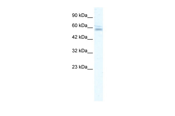 1 - ZNF141 antibody - N-terminal region AI11304