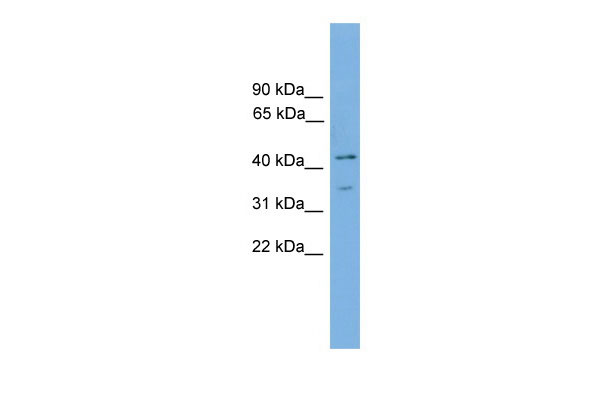 1 - Foxj1 antibody - middle region AI11321