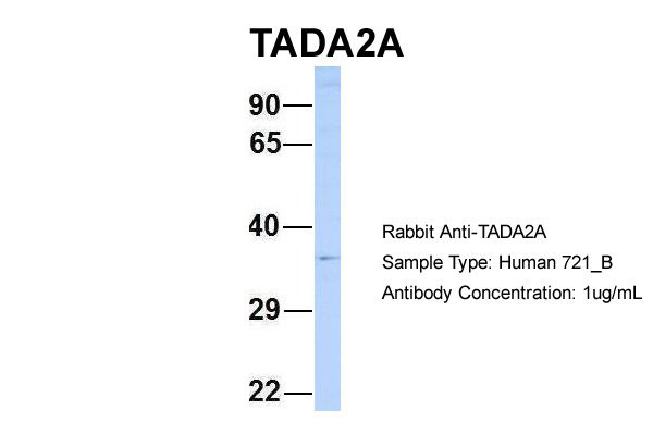 1 - TADA2L antibody - N-terminal region AI11355