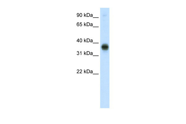 1 - E2F3 antibody - C-terminal region AI11359