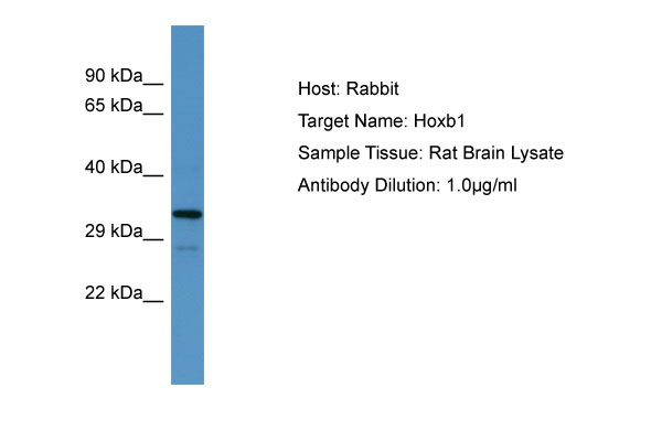 1 - Hoxb1 Antibody - N-terminal region AI11361