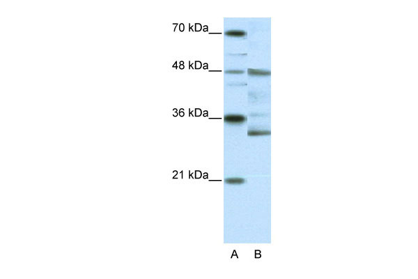 1 - HTLF antibody - N-terminal region AI11363
