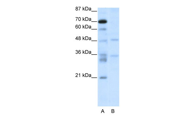 1 - HTLF antibody - C-terminal region AI11364