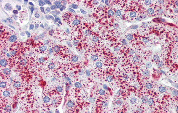 2 - SP4 antibody - middle region AI11382