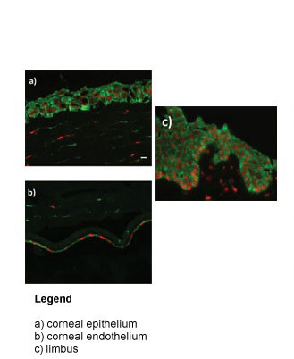 3 - ZNF133 antibody - middle region AI11393