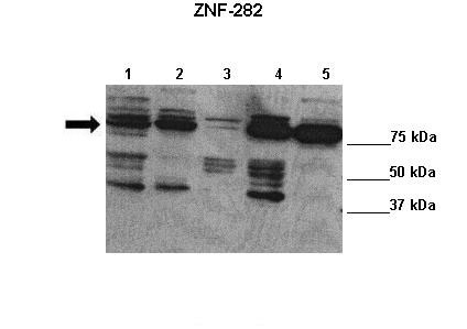 1 - ZNF282 antibody - C-terminal region AI11402