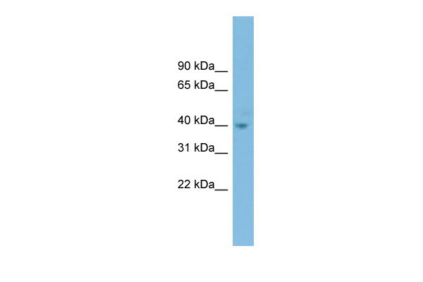 1 - FOXH1 antibody - N-terminal region AI11411