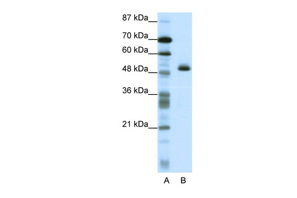 1 - ZNF213 antibody - N-terminal region AI11415
