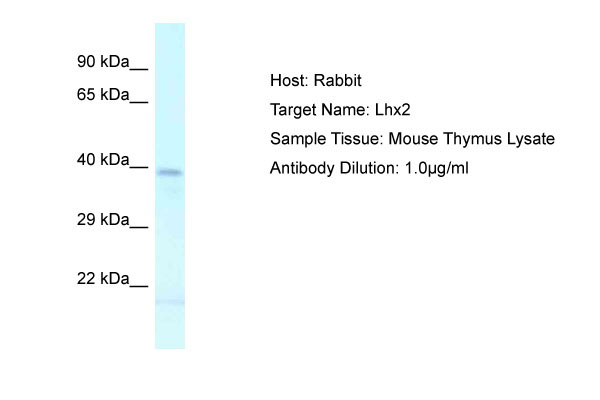 1 - Lhx2 Antibody - C-terminal region AI11423