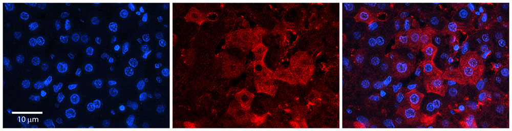 2 - ZNF142 antibody - C-terminal region AI11429