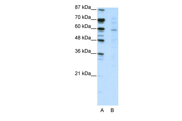 1 - CBFA2T3 antibody - N-terminal region AI11433