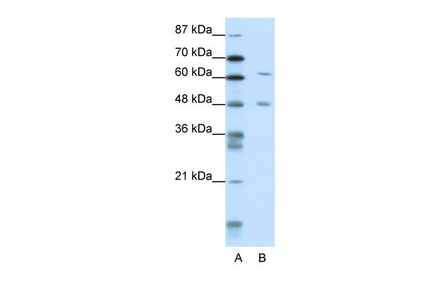 1 - NAB2 antibody - N-terminal region AI11449