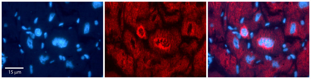 2 - NFATC1 antibody - N-terminal region AI11455