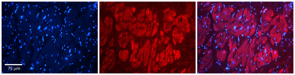 2 - NFATC1 antibody - middle region AI11456