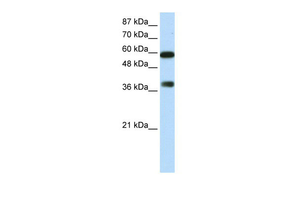 1 - ARID3B antibody - C-terminal region AI11464