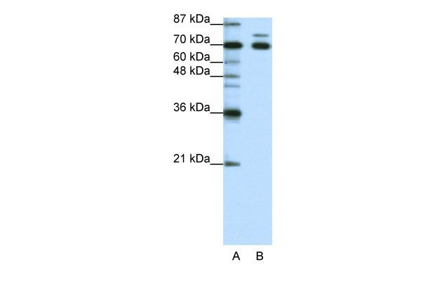 1 - TRIM16 antibody - N-terminal region AI11465