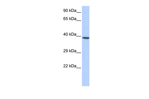 1 - HOXA2 antibody - middle region AI11468