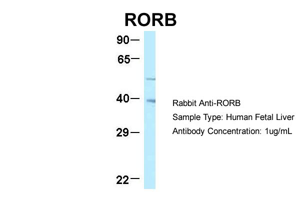 1 - RORB antibody - C-terminal region AI11471