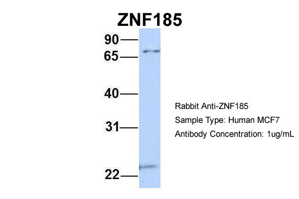 1 - ZNF185 antibody - N-terminal region AI11475