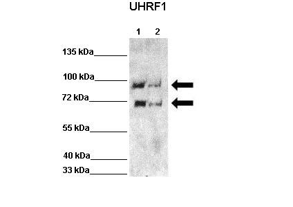 1 - UHRF1 antibody - N-terminal region AI11480