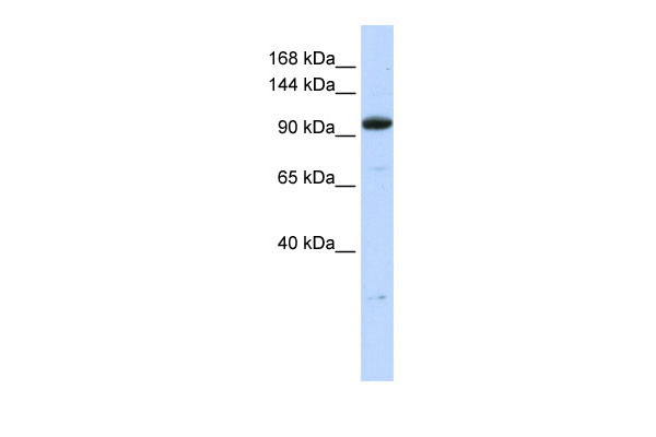 1 - ZNF228 antibody - N-terminal region AI11482