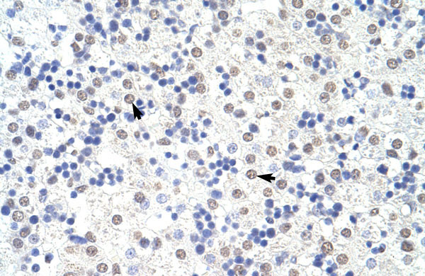 2 - SART3 antibody - N-terminal region AI11497