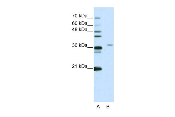 1 - SART3 antibody - N-terminal region AI11497