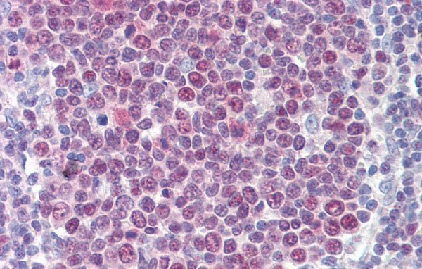 2 - TGFB1I1 antibody - N-terminal region AI11511