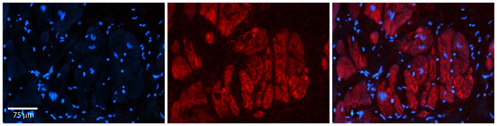 2 - Zfr antibody - N-terminal region AI11515
