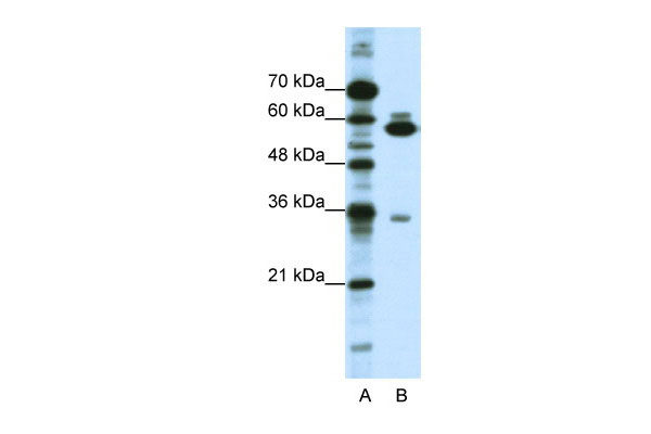 1 - ZNF446 antibody - C-terminal region AI11527