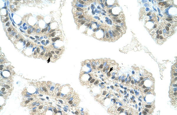 2 - JMJD2D antibody - C-terminal region AI11528
