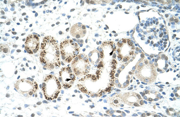 2 - JMJD2D antibody - C-terminal region AI11528