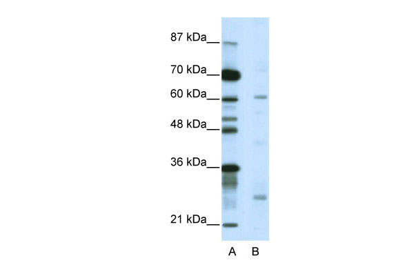 1 - NR1I2 antibody - C-terminal region AI11571