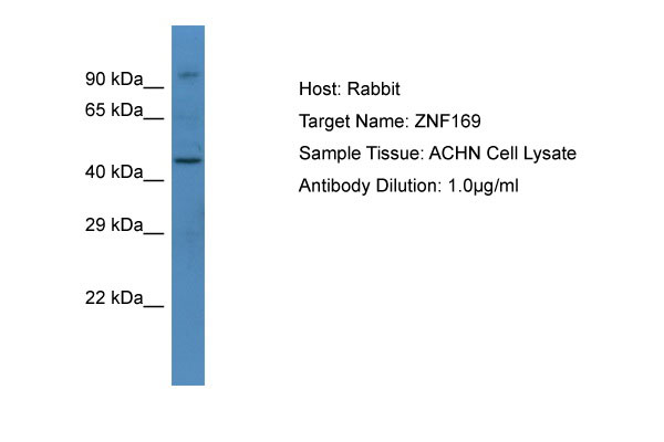 1 - ZNF169 Antibody - C-terminal region AI11573