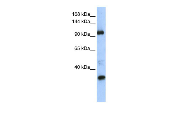1 - TUT1 antibody - middle region AI11580