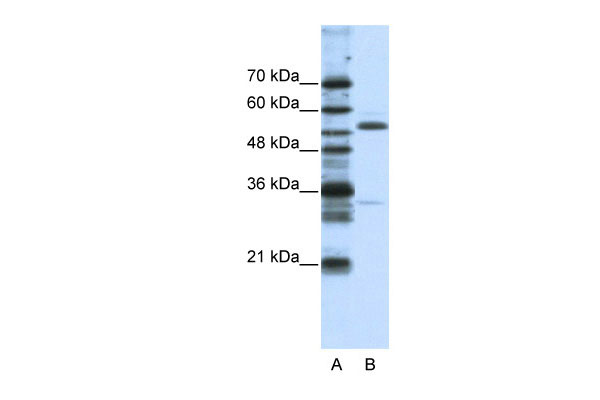 1 - ZNF655 antibody - N-terminal region AI11585