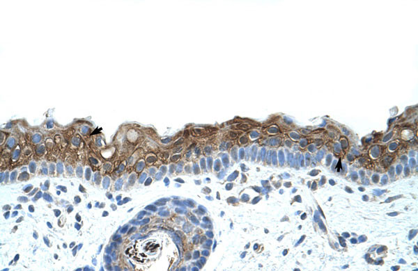 2 - ZNF397 antibody - C-terminal region AI11601