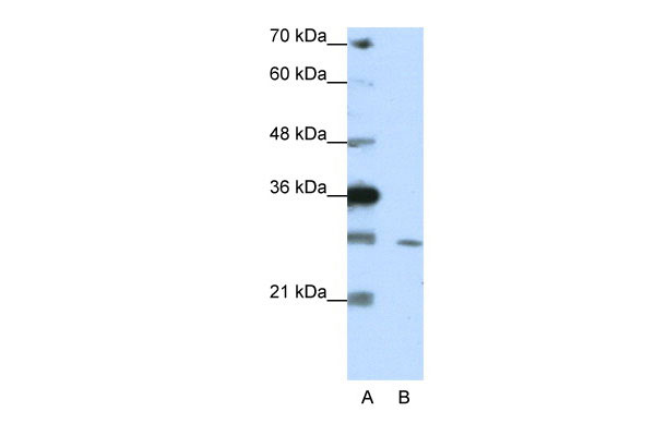 1 - ZNF397 antibody - C-terminal region AI11601