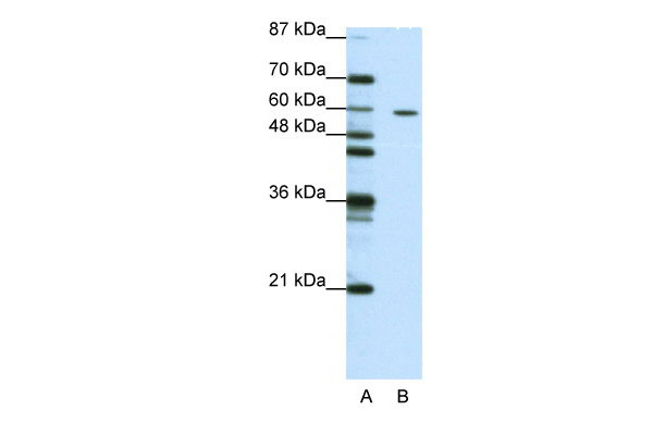 1 - ZNF382 antibody - N-terminal region AI11607