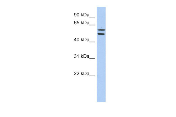 1 - ZNF513 antibody - middle region AI11626