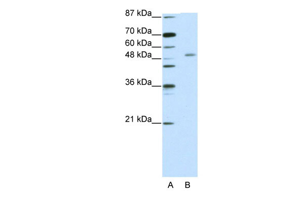 1 - ZNF498 antibody - C-terminal region AI11631
