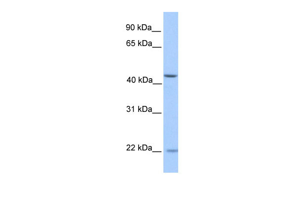 1 - ZNF485 antibody - N-terminal region AI11635