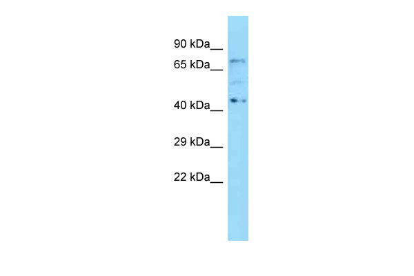 1 - Kbtbd5 antibody - N-terminal region AI11643
