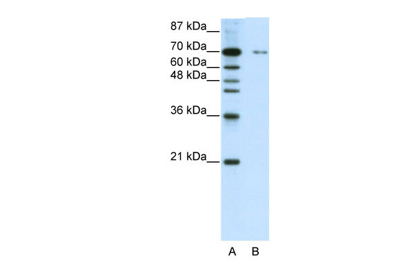1 - ZNF398 antibody - C-terminal region AI11655
