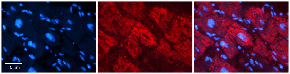 2 - NFATC1 antibody - N-terminal region AI11657